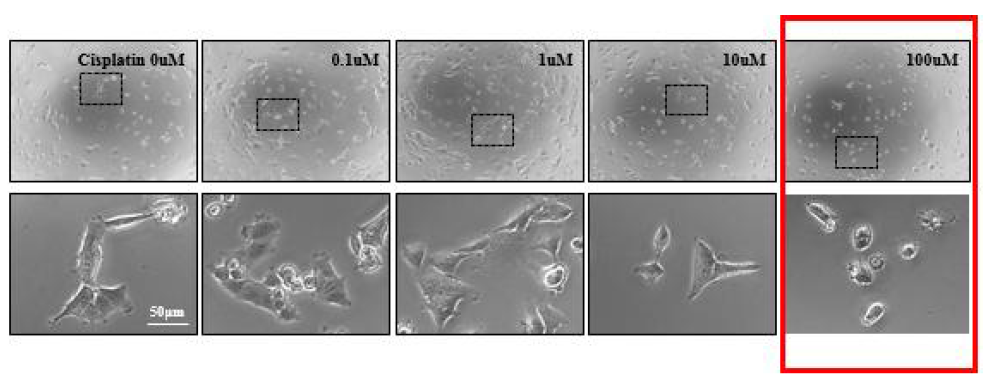cisplatin 처리 24시간 후 A549 세포의 형태변화