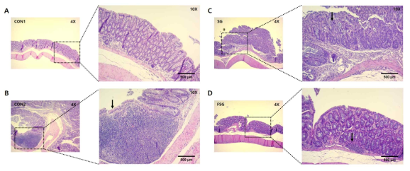 Hitology of AOM/DSS induced colon