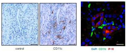 루푸스 신염 환자의 신장 조직 내 CD11c+ 대식세포의 확인