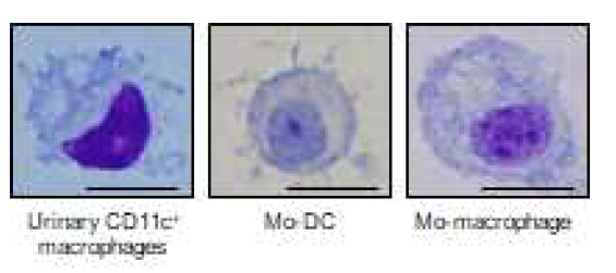 소변 CD11c+ 대식세포의 형태학적 특성