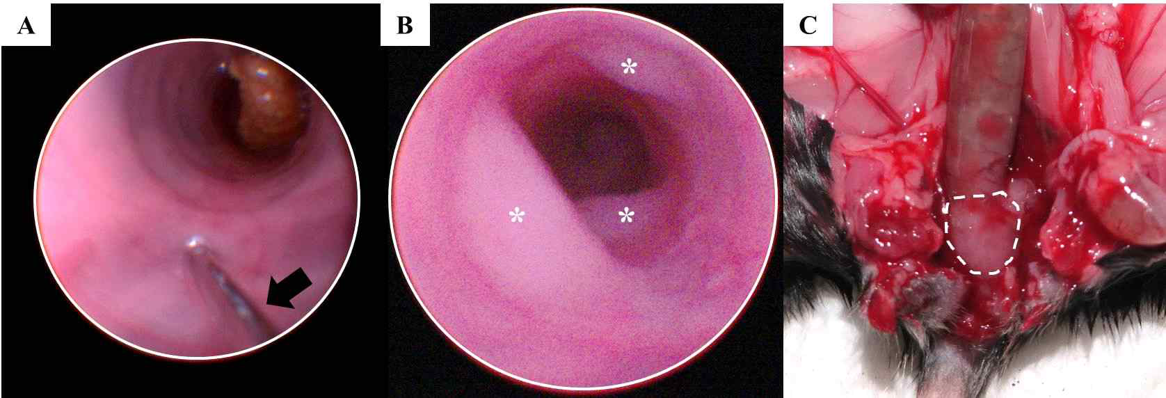 MC38 cancer cell을 이용한 정위 종양 모델의 제작. (A) 내시경적 tumor cell implantation을 시행하는 사진. 8인치 길이의 needle (흑색 화살표)을 이용하여 MC38 cancer cell을 주사함. (B) 암세포 주사 16일 후 촬영한 마우스의 대장 내시경 사진. Multiple tumor lesion (*) 들이 관찰됨. (C) 마우스 부검 후 확인한 대장 종양 조직. Bulk tumor가 (백색 점선부위) rectum 부위에 만들어져 있는 것을 확인함