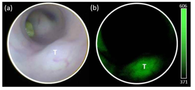 마우스 종양모델에서 촬영한 형광 박테리아의 영상. (a) 광시야 내시경으로 확인한 마우스 대장 내부의 종양 (T). (b) 종양 부위에서 확인한 녹색 형광 박테리아의 형광 신호