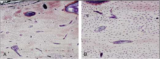 신생골과 정상 골조직의 조직학적 비교