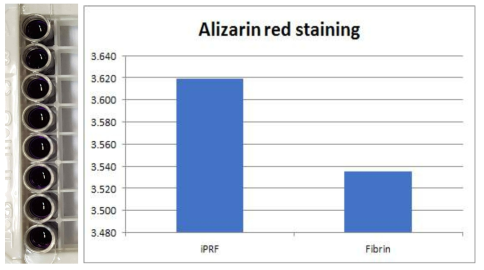 Alizarin red staining result