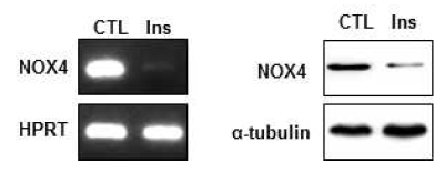 Insulin 에 의한 NOX4 발현 억제 효과 의 확인 왼쪽: RT-PCR 오른쪽: Western blot analysis