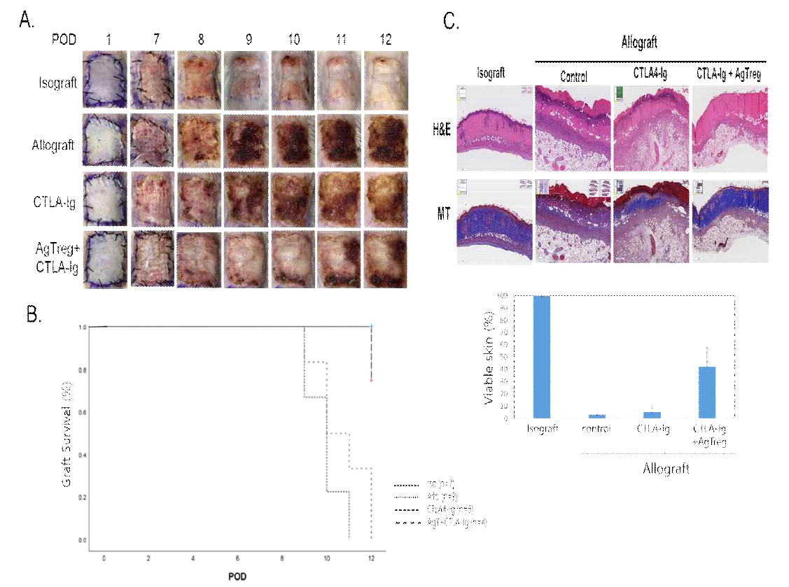 항원 특이 Treg cell의 피부동종이식의 면역관용 유도 A. 피부이식과 거부반응; B. Kaplan –Meier 이식 피부조직의 생존분석 ; C. H&E and Masson Trichom Staining. The data presented means ± sdv