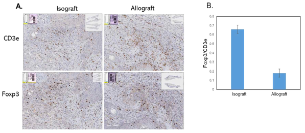 Isograft (n=4) 와 Allograft(n=4)의 피부 조직에서 CD3e, Foxp3의 조직염색 분석, The data presented means ± sdv