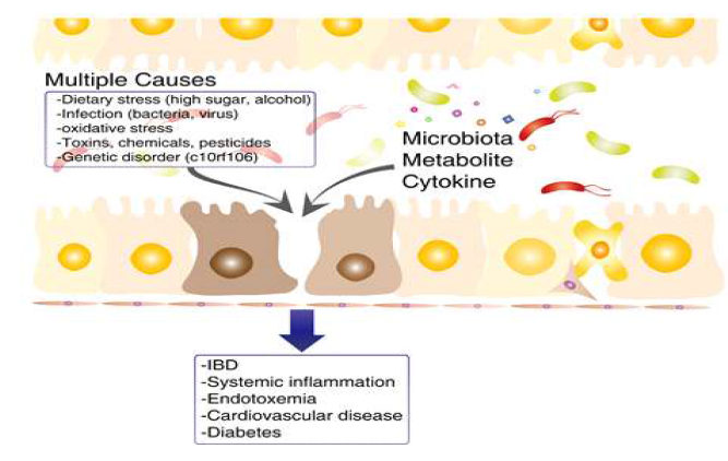 gut barrier dysfunction을 유도하는 다양한 원인과 관련 질환