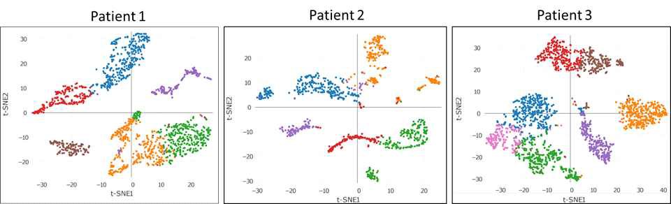 위암환자의 조직을 이용한 단일세포 유전체분석(RNA seq.:Chromium™ Single Cell 3’ ) 결과