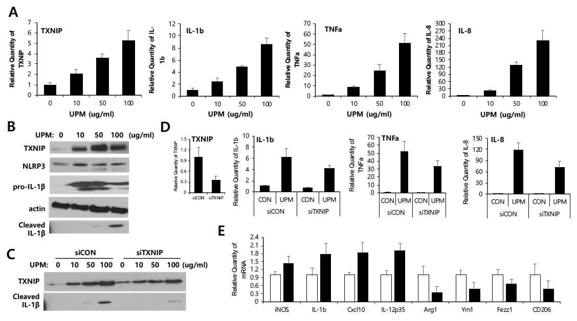 The effects of UPM-induced TXNIP on the macrophage polarization