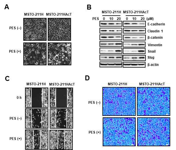 MSTO-211HAcT세포에서 pifithrin –u 의 EMT (Epithelial-mesencymal transition) 의 유도 효과. (A) cell morphology. (B) EMT 관련 marker 단백질 발현 분석 결과. (C) Scratch wound closure assay. (D) Cell migration assay. PES, pifithrin-u