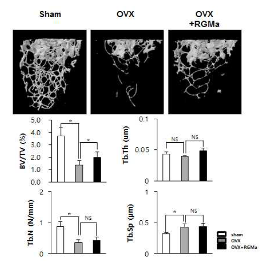 골다공증 동물모델에 RGMa 전신 투여 한 마우스의 micro-CT