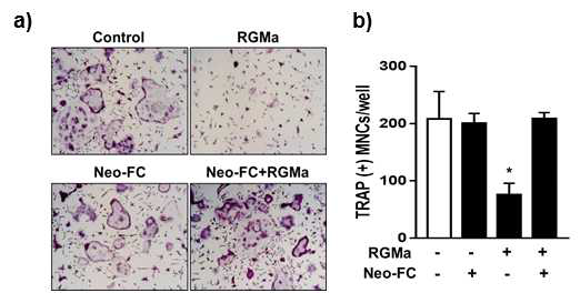 RGMa 수용체 억제에 따른 파골세포 분화 영향