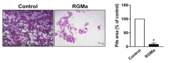 파골세포에 RGMa 처치 후 골흡수능 확인