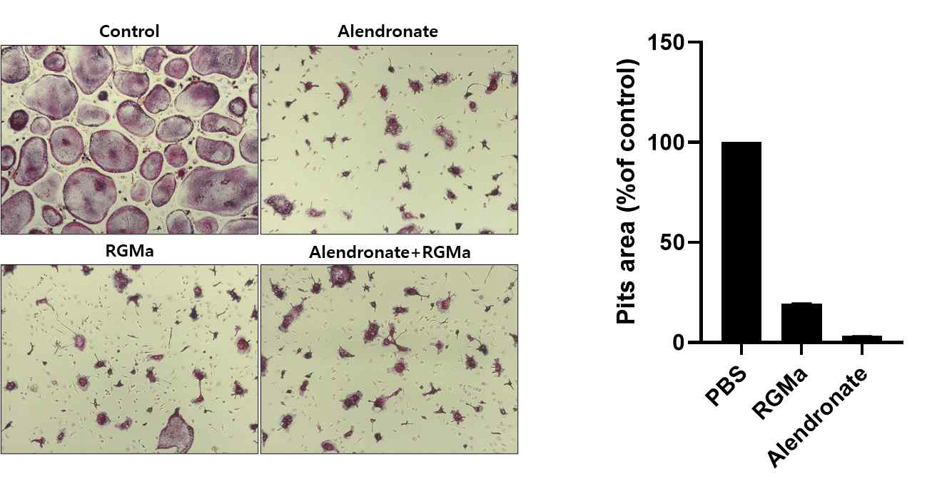 Alendronate 와 RGMa 의 파골세포 분화 억제 및 골흡수 억제능 비교