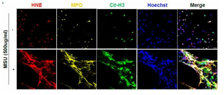 MSU 자극에 의한 neutrophil extracellular trap 형성확인