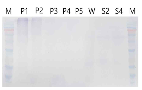 western blot을 이용한 발현 단 백질 검출. Lane M: PM2700(SMOBIO) protein size marker, Lanes P1-5: Positive control (WSSV virus stock), Lane W: Wild type total protein (Negative control), Lane S2, S4: Transformed C. vulgaris total protein