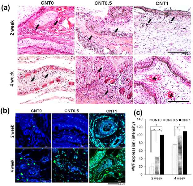 Bone regeneration analysis in calvaria at 8 weeks, by micro-CT and histology. (a) Micro-CT images, and (b) quantification of bone formation. (c) Histology of tissue samples by H&E and MT stains, and (D) High magnification of CNT1 group, revealing a matured new bone structure with many osteocytes in lacunae. Scale bar = 500 μm in (c,d)