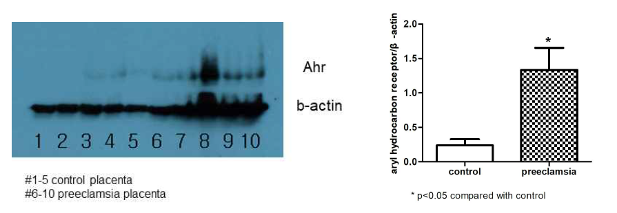 정상과 임신성 고혈압 환자의 태반 내 AhR의 단백질 농도 비교
