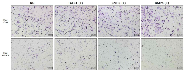 췌장암 세포주 AsPC-1 migration assay