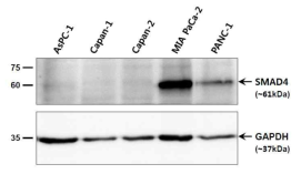 췌장암 세포주에서의 SMAD4 단백질 발현 측정