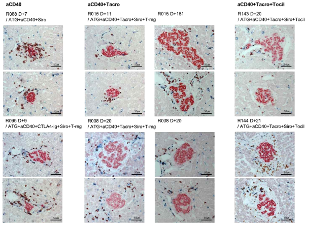 CD40 항체 기반 면역억제요법을 이용하여 이종췌도이식 결과