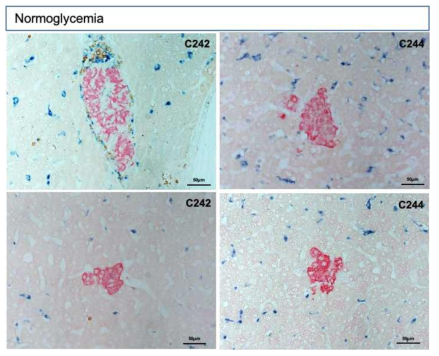 영장류 동종췌도이식의 면역조직화학법 결과. 정상혈당을 유지하는 시기 (이식후 22일)의 이식된 췌도의 형태, 영장류 간 조직에 분포하는 췌도(Red)는 면역세포 침윤 없이 인슐의 양성을 보임. 일부 면역거부반응이 일어난 췌도가 존재함.
