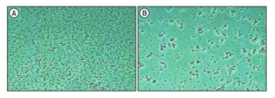 Phase-contrast microscopic analysis of antimicrobial activity in the presence of MIC of secreted protein of oraCMU. (A) Untreated P. gingivalis control. (B) P. gingivalis with secreted protein at 800 μg/mL. Magnification: × 4000