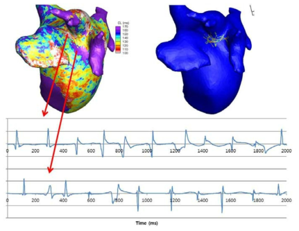 시뮬레이션으로 구현된 심장의 로터 중심과 가장자리에서의 심장 전기신호