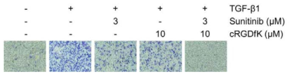 A549 세포에서 cRGDfK 병용투여를 통한 sunitinib 의 invasion 억제 상승효과