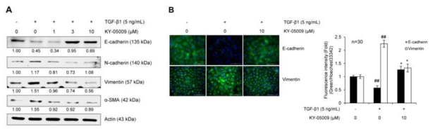 TNIK 억제제 KY-05009 의 EMT phenotype 억제 효과