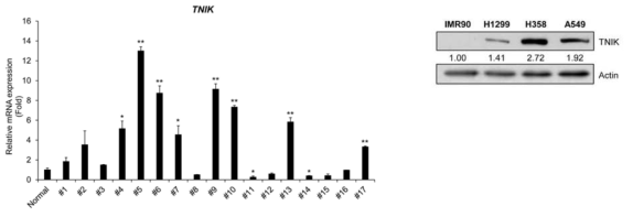 비소세포성 폐선암종 환자 검체 (좌) 및 세포주 (우) 에서의 TNIK 발현 여부 확인