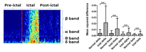 발작 전후 구간의 뇌파 주파수 파워 패턴 예시 및 뇌파 밴드별 차이