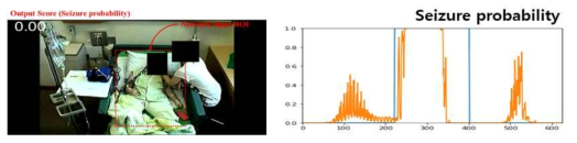 (좌) 실시간 환자 모니터링 영상 예시, (우) 검출된 seizure probability 결과