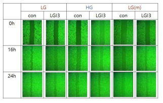 저농도(LG)와 고농도(HG), 그리고 저농도에 만니톨(LG(m))을 첨가한 배지에서 배양된 각질 형성세포에서 LGI3가 migration에 미치는 영향