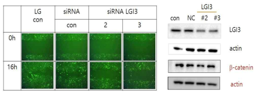 저농도 배지에서 각질형성세포를 LGI3에 대한 siRNA로 transfection 후 migration 관찰과 Western blot 결과 확인