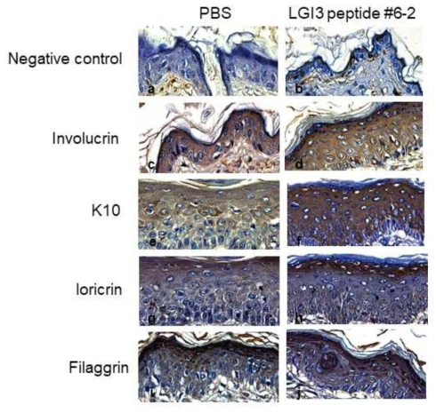 LGI3 펩타이드 6-2번이 마우스의 표피의 분화에 에 미치는 영향