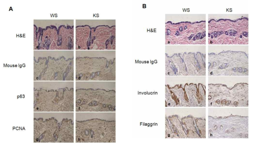 정상 mouse의 피부조직(WS)과 LGI3 knockout mouse의 피부(KS)에서 분화마커의 비교