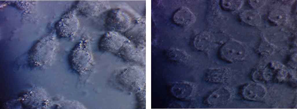 포르말린에 고정한 cell line. (좌) 정상세포, A549 (우) 방광암 세포, 5637