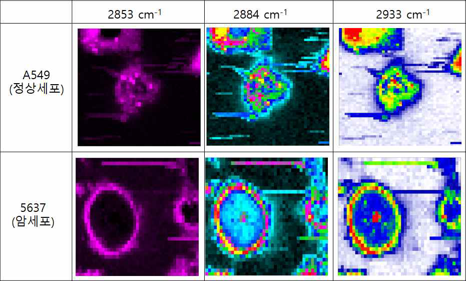 세포 영역에서의 A549 (정상세포) 와 5637 (방광암 세포)의 라만 스펙트럼