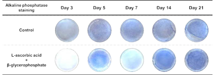 치주인대세포 분화과정에서 ALP 염색. 분화 5일부터 L-ascorbic acid+β-glycerophosphate 군의 ALP 염색성이 강해짐
