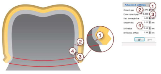 Internal gap 설정