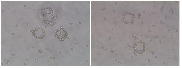 microparticle에 breast cancer cell line이 binding한 모습