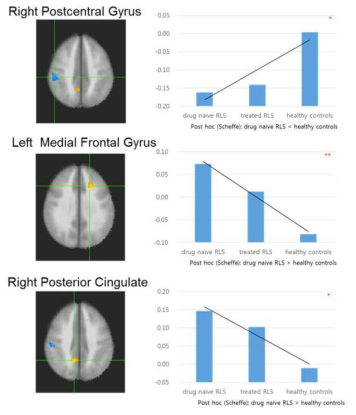The patterns of the basal connectivity strength with the thalamus among the three groups