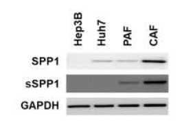 Hep3B, Huh7, PAF, CAF에서 SPP1 의 발현 확인함. 세포주에서의 SPP1 발현도 CAF가 가장 높았으면, 배양액에서 측정한 secreted SSP1 (sSPP1)의 발현 도 CAF CM에서 가장 높았음