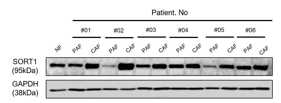 PAF/CAF 세포주에서 SORT1의 단백질 발현 수준 확인