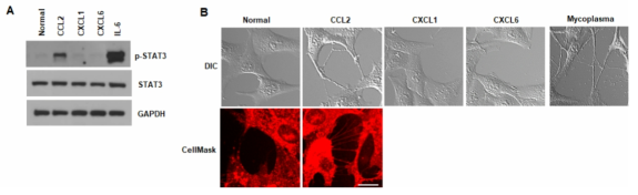 CCL2에 의한 STAT3 phosphorylation과 사이토님 생성