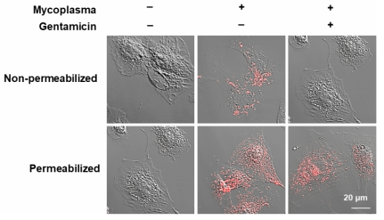 Intracellular micoplasma의 존재 가능성