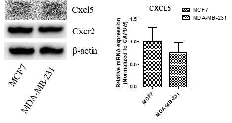 유방암 세포주를 이용한 cxcr2, cxcl5 발현 비교