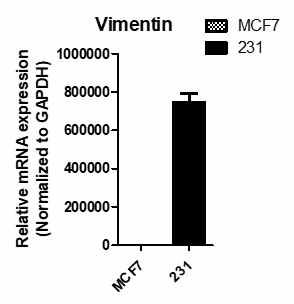 MDA-MB-231 세포주와 MCF세포주 에서암세포 전이의 차이점 관찰